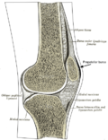 Thumbnail for Infrapatellar bursitis