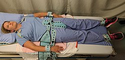 An example of physical restraints which may be used until chemical sedation takes effect.