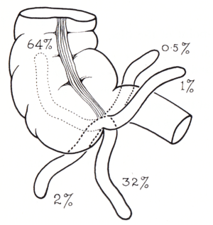 Situs appendicis vermiformis