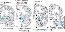 Anatomie-Basalganglien-A.jpg