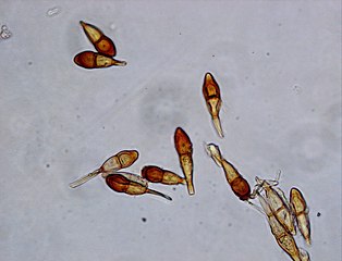 Teliospory rdzy zbożowej z trzonkami