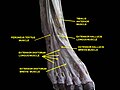 Dorsum of foot. Deep dissection.