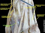 Extensor indicis muscle