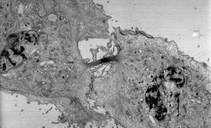 Een elektronenmicroscopische afbeelding van een delende dierlijke cel; de mitose is voltooid en de celdeling en cytokinese zijn bijna voltooid. De pijl wijst de plaats aan waar bij een van de celkernen een centrosoom nog zichtbaar is.