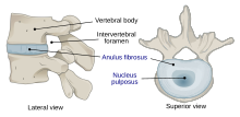 716 Intervertebral Disk.svg