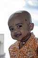 Image 12A Hindu girl after her Karnavedha rite of passage (ear piercing) (from Samskara (rite of passage))