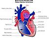 Patent ductus arteriosus