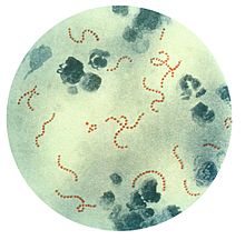 Streptococcus pyogenes litaðar með aðferð Pappenheims.