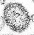 Measles virus. Ini ing ausan dang thin section (maimpis pangabangal) nung nu ya mepitna king adua ing virus.