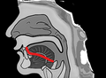 The shape of tongue when pronouncing ㄴ (n)