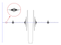 Volerra function