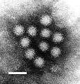 Norovirus. Ining RNA virus ing mágdala king winter vomiting disease (pamaniuka neng karimla). Maralas yang mibabalitang sangkan ning gastro-enteritis kareng bapor a pang-cruise ampo kareng ospital.