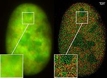 超高分辨率顯微鏡：共定位顯微鏡（2CLM），綠色螢光蛋白（GFP）和紅色螢光蛋白（RFP）融合蛋白（骨癌細胞的細胞核）