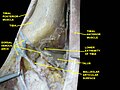 Dorsum of foot. Ankle joint. Deep dissection.