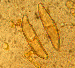 Teliospory Gymnosporangium clavariiforme