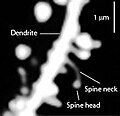 Thumbnail for Dendritic spine