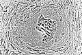 Light micrograph of undecalcified tissue displaying osteoblasts actively synthesizing rudimentary bone tissue (center).