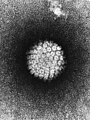 Ing Human Papilloma Virus