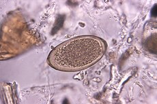 Trichuris vulpis ei