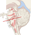 Bahagian sagital batang otak