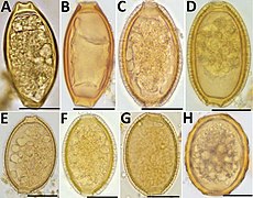 C t/m G: Eieren van Capillaria sp.