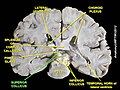 Superior colliculus (coronal section)